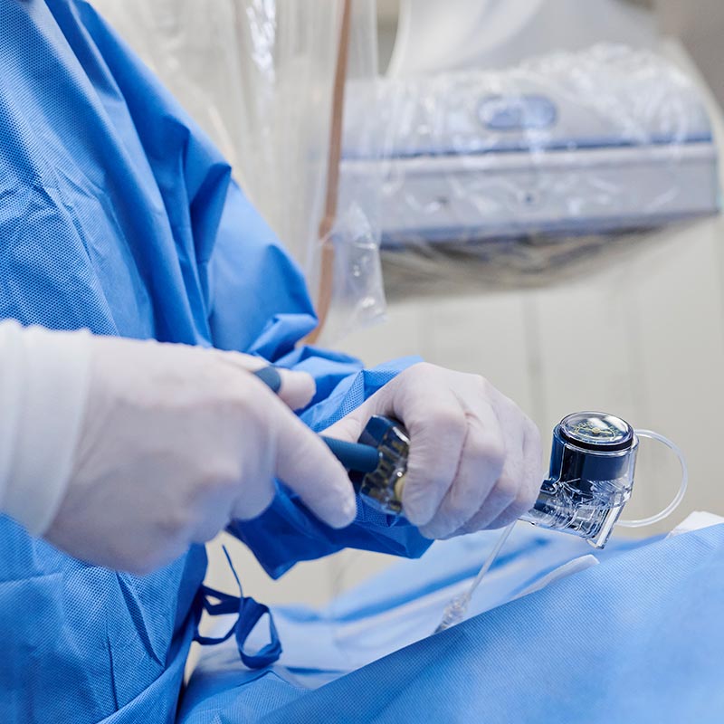 Ein Mediziner in blauer OP-Kleidung hält ein medizinisches Instrument in der Hand.