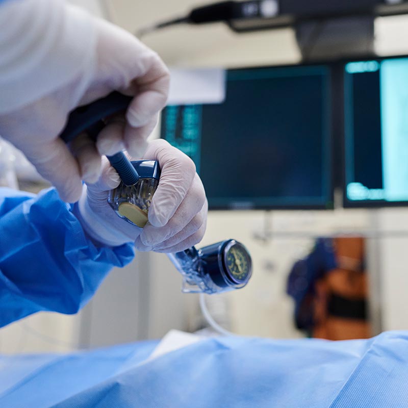 Medizinisches Personal hält ein Endoskop in einem Operationssaal mit Monitoren im Hintergrund.