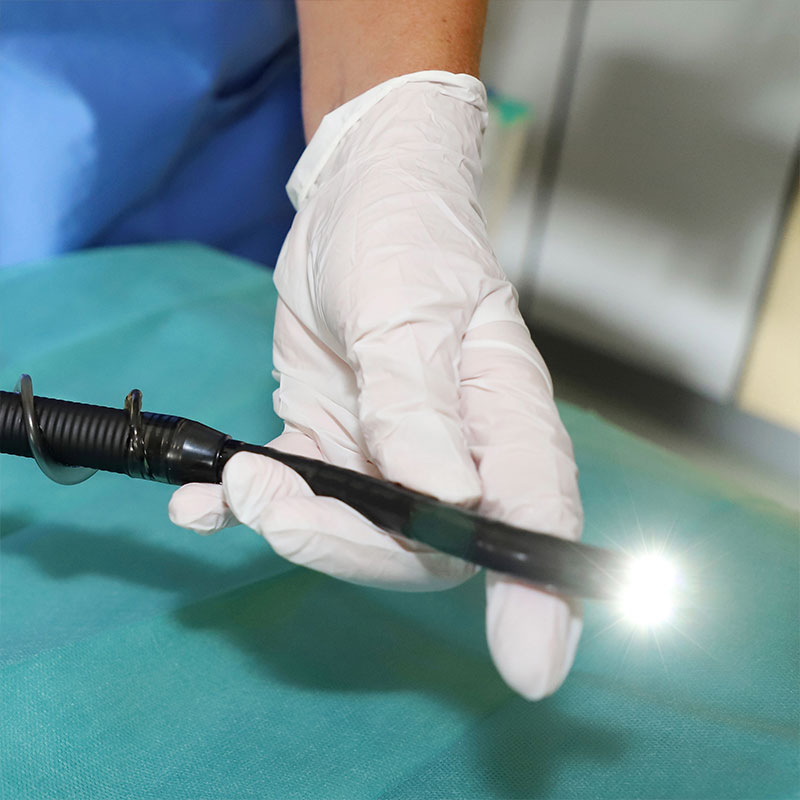 Eine Hand in einem Handschuh hält ein Endoskop mit leuchtendem Licht.