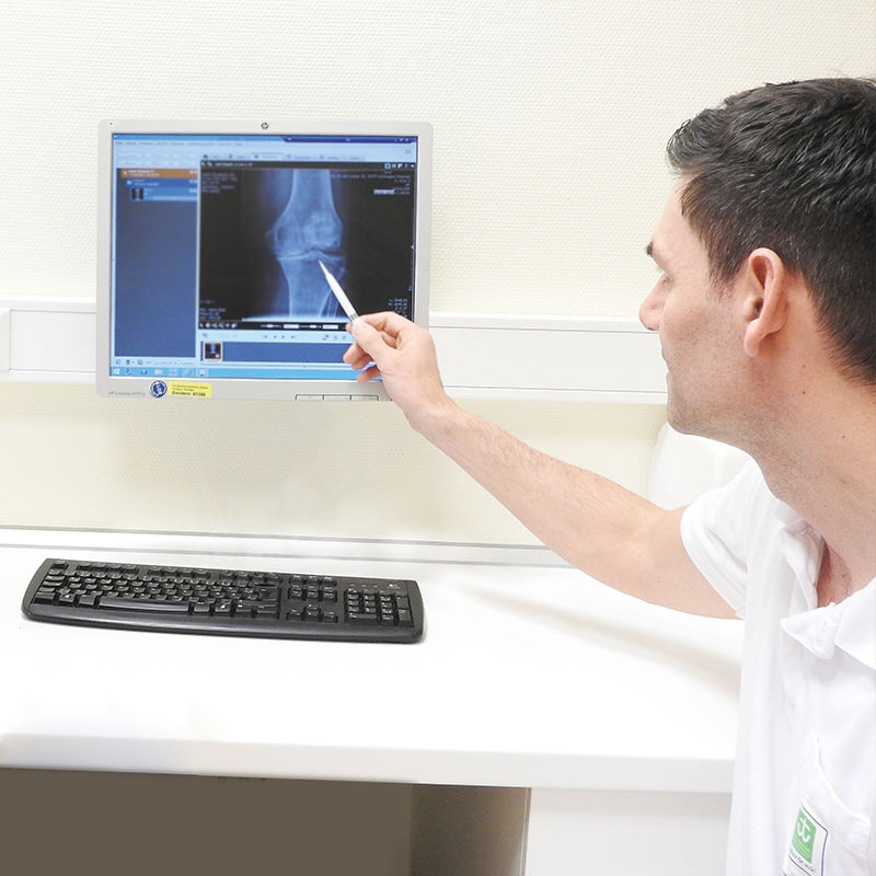 Ein Mann zeigt auf ein Röntgenbild eines Knies auf einem Computerbildschirm.