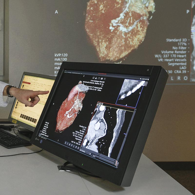 Ein Arzt zeigt auf CT-Scans eines Herzens auf einem Computermonitor in einem medizinischen Umfeld.