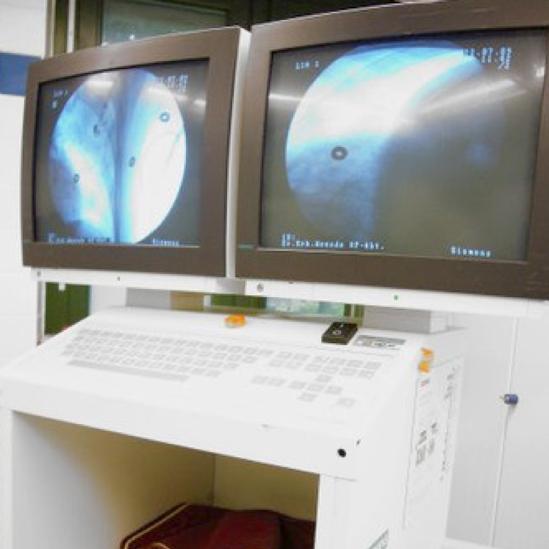 Zwei Monitore zeigen medizinische Bilder, vermutlich von einer Röntgen- oder Endoskopieuntersuchung, auf einem Pult.