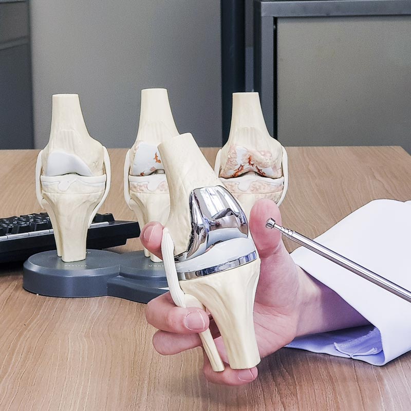 Hand hält künstliches Kniegelenk-Modell mit Metallimplantat, mehrere ähnliche Modelle im Hintergrund auf dem Tisch.