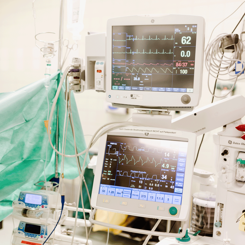 Krankenhaus-Operationssaal mit Herz-Kreislauf- und Überwachungsgeräten. Monitore zeigen Vitaldaten.